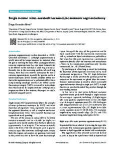 Masters of Cardiothoracic Surgery  Single incision video-assisted thoracoscopic anatomic segmentectomy