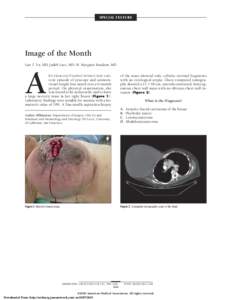 SPECIAL FEATURE  Image of the Month Lan T. Vu, MD; Judith Luce, MD; M. Margaret Knudson, MD  A