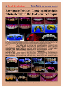 DENTAL TRIBUNE  12 Trends & Applications Asia Pacific Edition No. 1+2/2015