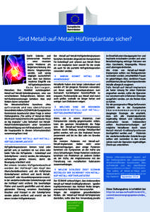 Sind Metall-auf-Metall-Hüftimplantate sicher? Steife Gelenke und schmerzende Knochen – einst mussten