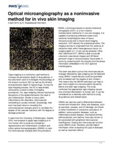 Optical microangiography as a noninvasive method for in vivo skin imaging