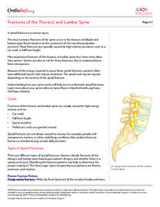 Burst fracture / Compression fracture / Orthopedic surgery / Orthopedic surgeons / Spinal cord injury / Osteoporosis / Human vertebral column / Spinal fusion / Andrew C. Hecht / Medicine / Traumatology / Bone fractures
