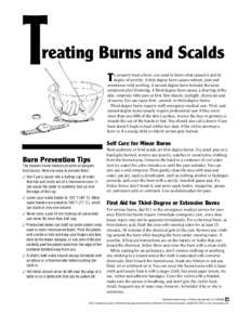 T  reating Burns and Scalds T  o properly treat a burn, you need to know what caused it and its