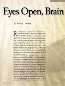 Eyes Open, Brain By Steven Laureys R  32
