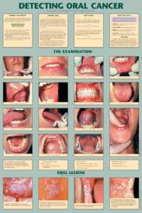 DETECTING ORAL CANCER A Guide for Health Care Professionals INCIDENCE AND SURVIVAL  WARNING SIGNS