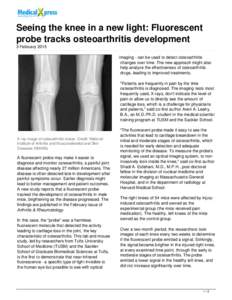 Seeing the knee in a new light: Fluorescent probe tracks osteoarthritis development