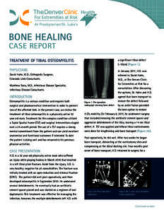 BONE HEALING CASE REPORT TREATMENT OF TIBIAL OSTEOMYELITIS PHYSICIANS David Hahn, M.D., Orthopedic Surgeon,