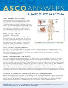ASCO ANSWER S  R H A B D O M YO S A RCO M A Illustration by Robert Morreale/Visual Explanations, LLC. © 2004 American Society of Clinical Oncology.  WHAT IS RHABDOMYOSARCOMA?