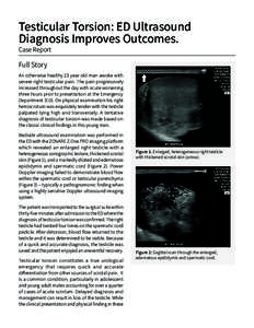 Testicular Torsion: ED Ultrasound Diagnosis Improves Outcomes. Case Report Full Story An otherwise healthy 23 year old man awoke with
