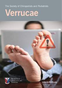 The Society of Chiropodists and Podiatrists  Verrucae The Society of Chiropodists and
