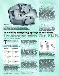 Figure 1: Internal surfaces of the edgewise archwire slot are modified to create the Tip-Edge archwire slot. Tipping surfaces (T) limit crown tipping during retraction. Uprighting surfaces (U) control final tip and torqu