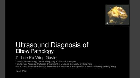 Ultrasound Diagnosis of Elbow Pathology Dr Lee Ka Wing Gavin Director, Rheumatology Centre, Hong Kong Sanatorium & Hospital Hon. Clinical Associate Professor, Department of Medicine, University of Hong Kong Hon. Clinical