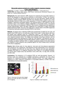 Myocardial oedema evaluation by cardiac magnetic resonance imaging: a new “gold standard”? E.McAlindon1, C.Lawton1, P.Weale2, X.Bi2, N.Manghat1, M.Hamilton1, C.Bucciarelli-Ducci1 1 Cardiac MRI Unit, Bristol Heart Ins