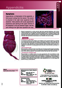 Appendicitis Symptoms Appendicitis is inflammation of the appendix, a blind pouch arising from the cecum. The cecum is situated in the right lower quadrant of the abdomen. Most patients with acute appendicitis