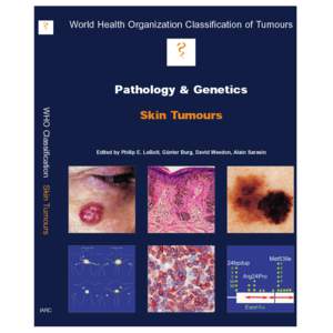 World Health Organization Classification of Tumours Kleihues P., Cavenee W.K. (Eds.): World Health Organization Classification of Tumours. Pathology and Genetics of Tumours of the Nervous System.