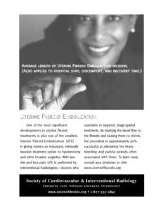 Average length of Uterine Fibroid Embolization incision. ( Also applies to hospital stay, discomfort, and recovery time. ) U TERINE F IBROID E MBOLIZATION One of the most significant