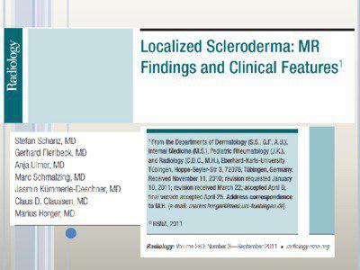 Les sclérodermies localisées sont : La sclérodermie en goutte, petits éléments arrondis, de coloration blanche et d’aspect nacré, se situant essentiellement au niveau du