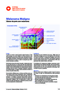 Melanoma Malígno Câncer de pele com melanoma Composição da Pele células pigmentárias (melanócitos)
