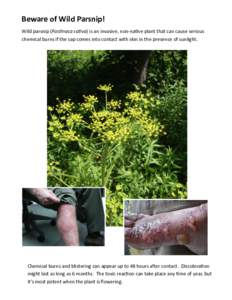 Beware of Wild Parsnip! Wild parsnip (Pastinaca sativa) is an invasive, non-native plant that can cause serious chemical burns if the sap comes into contact with skin in the presence of sunlight. Chemical burns and blist