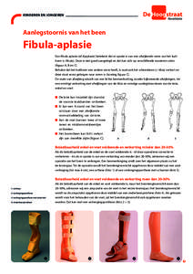 KINDEREN EN JONGEREN  Aanlegstoornis van het been Fibula-aplasie Een ﬁbula aplasie (of dysplasie) betekent dat er sprake is van een afwijkende vorm van het kuitbeen (= ﬁbula). Deze is niet goed aangelegd en dat kan z