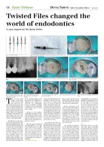 14 Endo Tribune  United Kingdom Edition June 2014