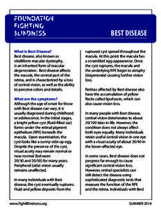 BEST DISEASE What is Best Disease? Best disease, also known as vitelliform macular dystrophy, is an inherited form of macular degeneration. Best disease affects