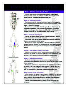 Lumbar Facet Injection For Chronic Low Back Pain A lumbar facet injection is an outpatient procedure for diagnosing and treating low back, buttock, hip, and groin pain. This information sheet will explain what it is. You