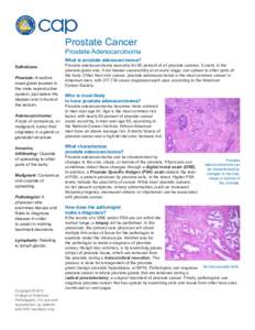 Prostate Cancer  Prostate Adenocarcinoma What is prostate adenocarcinoma? Definitions Prostate: A walnutsized gland located in