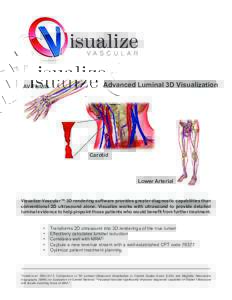 AV Fistula  Advanced Luminal 3D Visualization Carotid