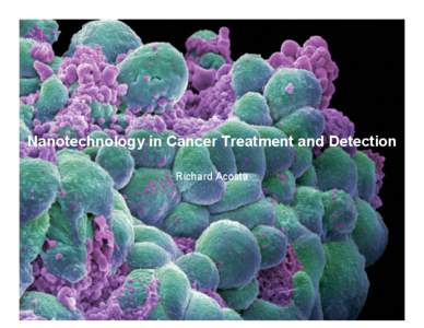 B0006421 Breast cancer cells