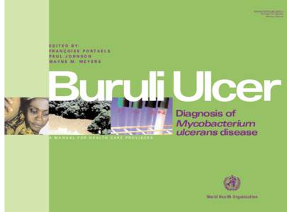 Corynebacterineae / Neglected diseases / Tropical diseases / Bacteriology / Buruli ulcer / Mycobacterium ulcerans / Mycobacterium / ANESVAD Foundation / Armed Forces Institute of Pathology / Bacteria / Microbiology / Bacterial diseases