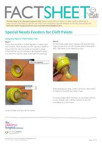 Special Needs Feeders for Cleft Palate Using the Pigeon® Cleft Palate Teat Step 1: Ensure that the white milk flow regulator is always used with the teat. Push the teat into the ring cap or platform. Ensure that the not