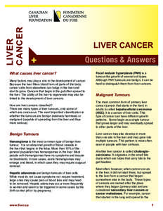 Hepatocellular carcinoma / Liver transplantation / Liver disease / Liver / Cholangiocarcinoma / Fatty liver / Chronic liver disease / Hepatitis / Metastasis / Medicine / Hepatology / Liver cancer