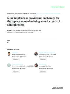 See	discussions,	stats,	and	author	profiles	for	this	publication	at:	https://www.researchgate.net/publicationMini-implants	as	provisional	anchorage	for the	replacement	of	missing	anterior	teeth:	A clinical	re