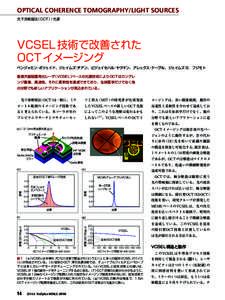 OPTICAL COHERENCE TOMOGRAPHY/LIGHT SOURCES 光干渉断層法 （ OCT ）/ 光源 VCSEL 技術で改善された OCT イメージング