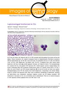 Lymphocyte / CD38 / Blood film / B-cell chronic lymphocytic leukemia / Blood tests / Medicine / Complete blood count