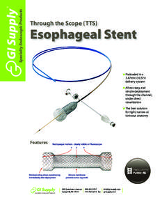 Specialty Endoscopic Products  Through the Scope (TTS) Esophageal Stent ● Preloaded in a