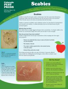 Scabies / Sarcoptiformes / Sarcoptes scabiei / Mange / Acari / Mite / Rash / Burrow / Acariasis / Medicine / Parasitology / Biology