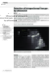 Education  Detection of intraperitoneal free gas by ultrasound Abstract Introduction: Patients with acute abdominal pain may have unsuspected pneumoperitoneum, and be