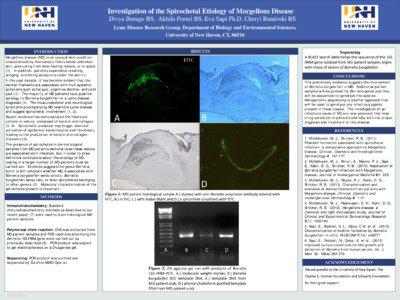 Investigation of the Spirochetal Etiology of Morgellons Disease Divya Burugu BS, Akhila Poruri BS, Eva Sapi Ph.D, Cheryl Bandoski BS Lyme Disease Research Group, Department of Biology and Environmental Sciences,