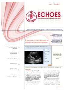 Issue 15  Spring 2013 ECHOES ECHOES