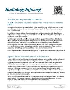 Escanear para enlace móvil.  Biopsia de aspiración pulmonar En qué consiste la biopsia de aspiración de nódulos pulmonares (tórax) Un nódulo es una lesión relativamente redonda, o área de tejido anormal, ubic