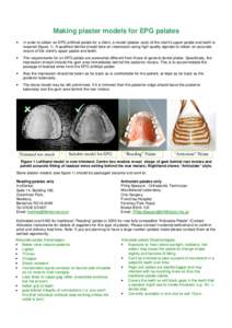 Making plaster models for EPG palates • In order to obtain an EPG artificial palate for a client, a model (plaster cast) of the client’s upper palate and teeth is required (figure 1). A qualified dentist should take 