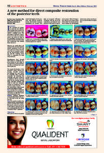 12 AESTHETICS  Dental tribune Middle East & Africa Edition | February 2015 A new method for direct composite restoration of the posterior teeth