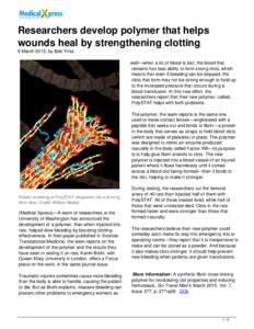 Researchers develop polymer that helps wounds heal by strengthening clotting
