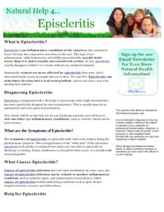 Natural Help for Episcleritis