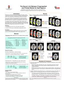 The Neural Link Between Fingerspelled and Printed Words for Deaf Signers Jill Weisberg, Jennifer Petrich, Stephen McCullough, and Karen Emmorey Laboratory for Language & Cognitive Neuroscience, San Diego State University