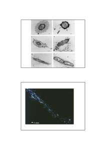 Virus / Particle / Microbiology / Microorganism / Fluence