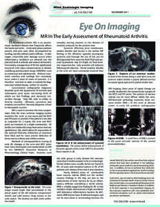 NOVEMBER 2011 Issue 8  Eye On Imaging MR In The Early Assessment of Rheumatoid Arthritis  R