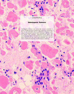 CHAPTER 6 Odontogenic Tumours
